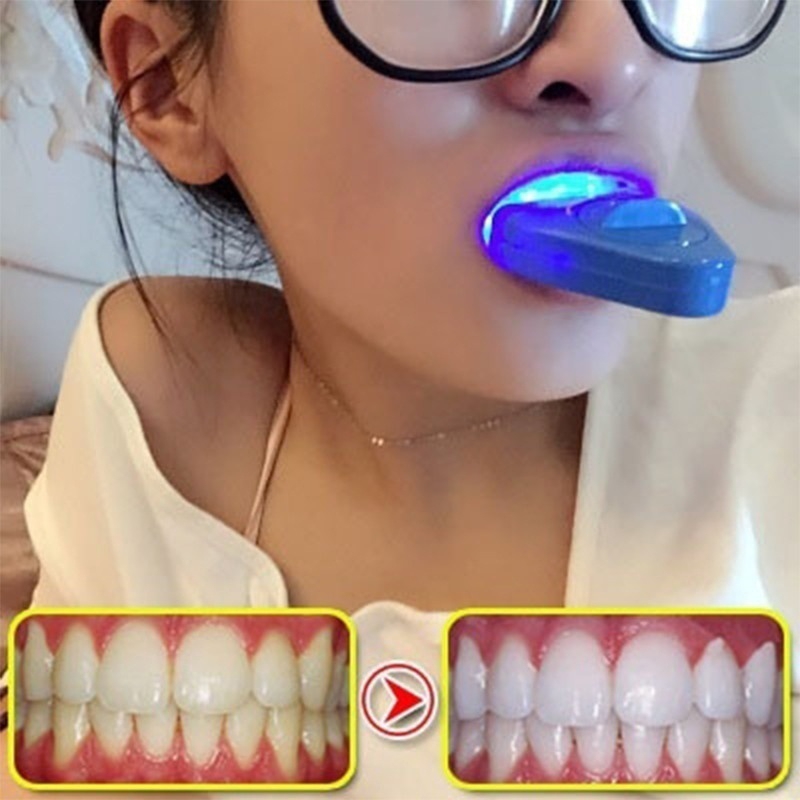Teeth Whitening With Laser - LED Teeth Whitening Light Whitening Blue