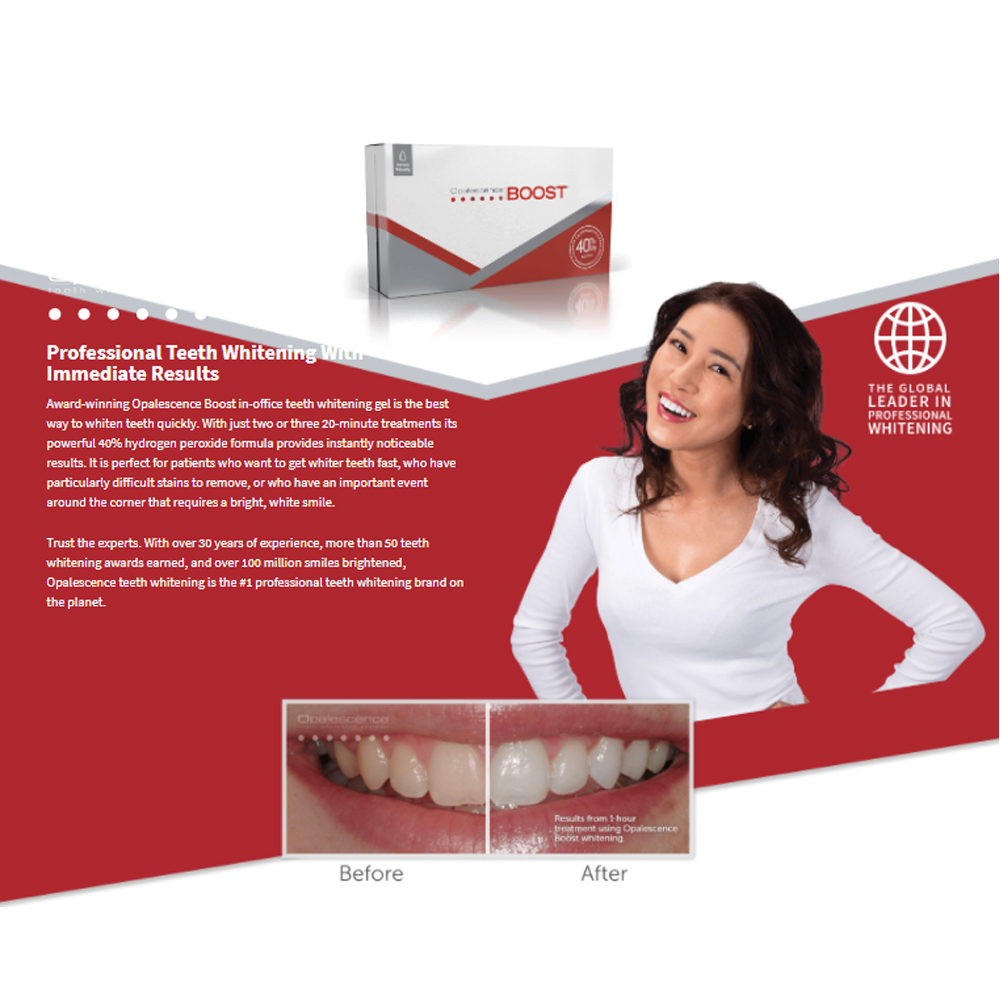 Opalescence Boost 40% PF Ameri - огляд і ціна Teeth Whitening Gel Opalescence