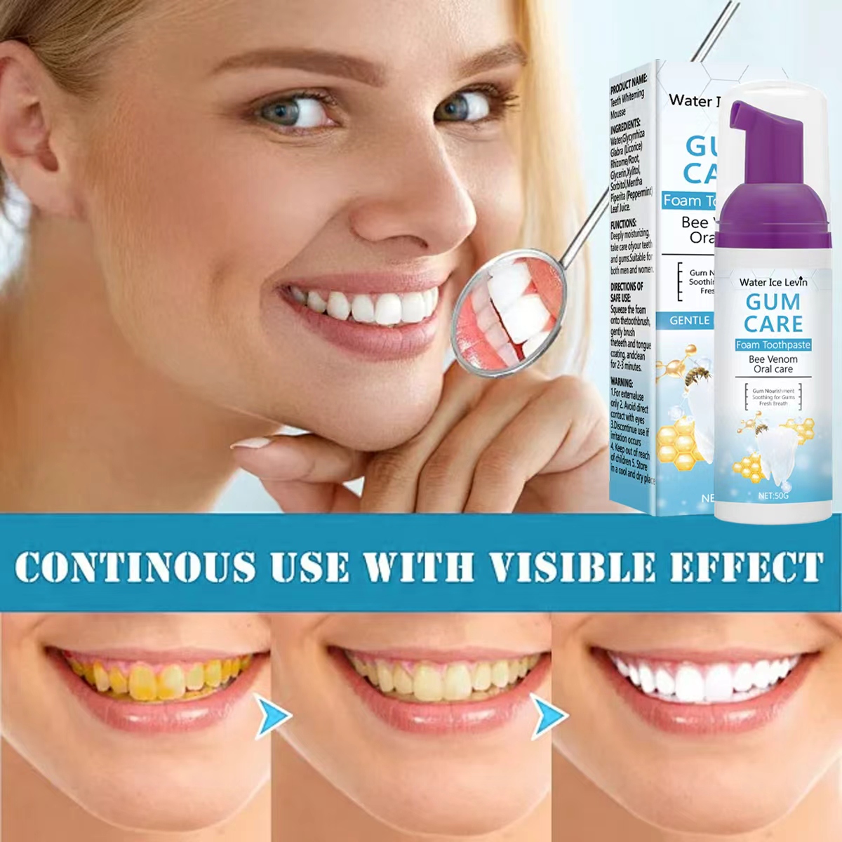 Water Ice Levin Gum Care Foam  - огляд і ціна Teeth Whitening Xylitol Gum