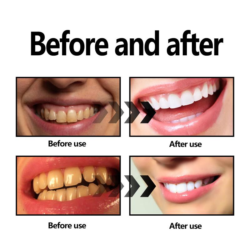 Teeth Whitening Powder Charcoa - огляд і ціна Teeth Whitening With Baking Soda