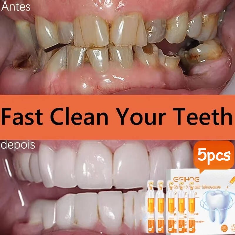 Quickly Repair Gum Serum Relie - огляд і ціна Teeth Whitening With Baking Soda