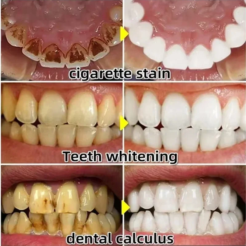 Quickly Repair Gum Serum Relie - огляд і ціна Teeth Whitening With Baking Soda