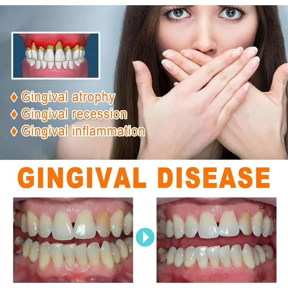 Quickly Repair Gum Serum Relie - огляд і ціна Teeth Whitening With Baking Soda
