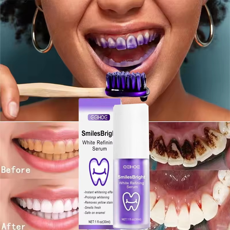Teeth Cleansing Whitening Toot - огляд і ціна Teeth Whitening Korea