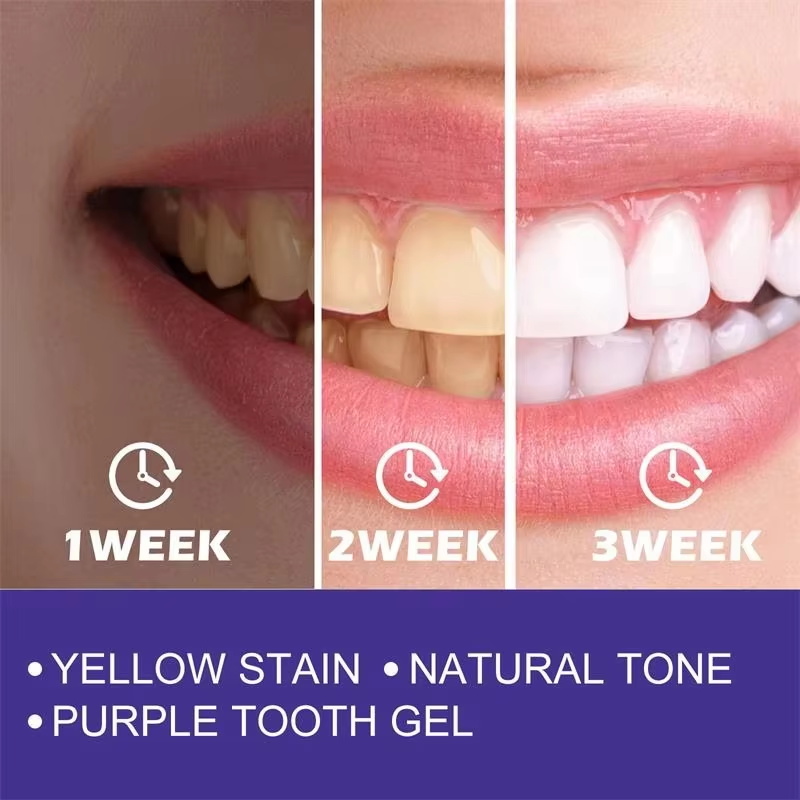 Teeth Cleansing Whitening Toot - огляд і ціна Teeth Whitening Korea