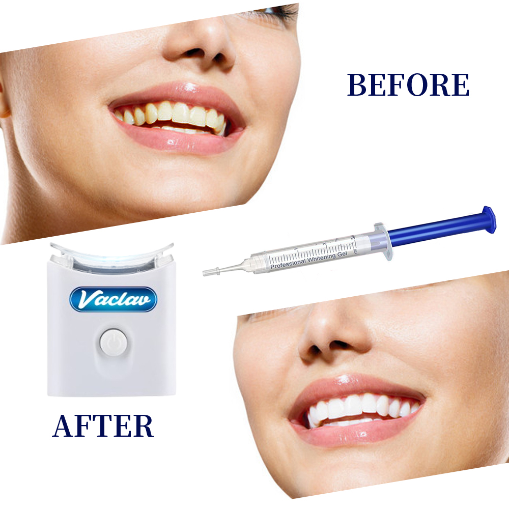 Mint Teeth Whitening Gel Syrin - огляд і ціна Teeth Whitening With Baking Soda