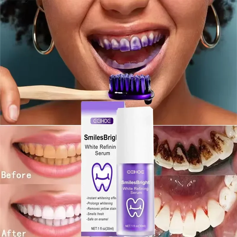 Teeth Cleansing Whitening Toot - огляд і ціна Teeth Whitening Korea
