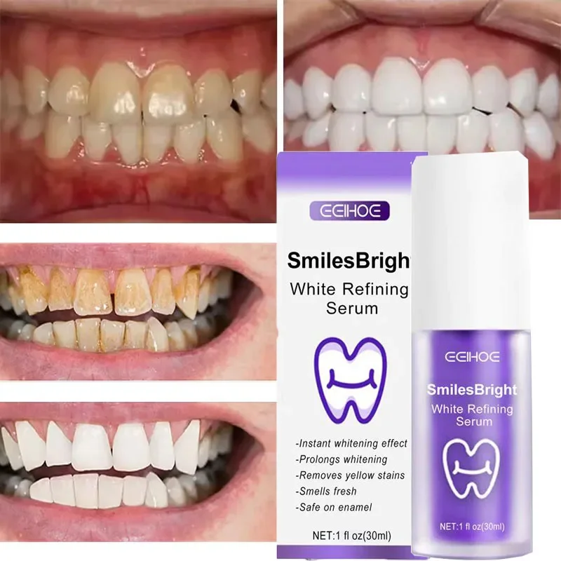 Teeth Cleansing Whitening Toot - огляд і ціна Teeth Whitening Korea