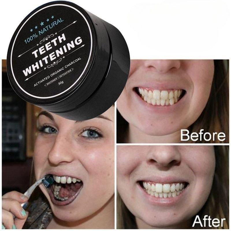 1 Box Activated Charcoal Teeth - огляд і ціна Whitening Powder Activated