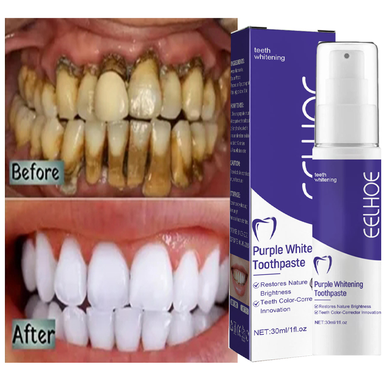 1pcs Teeth Cleansing Whitening - огляд і ціна Teeth Whitening Korea