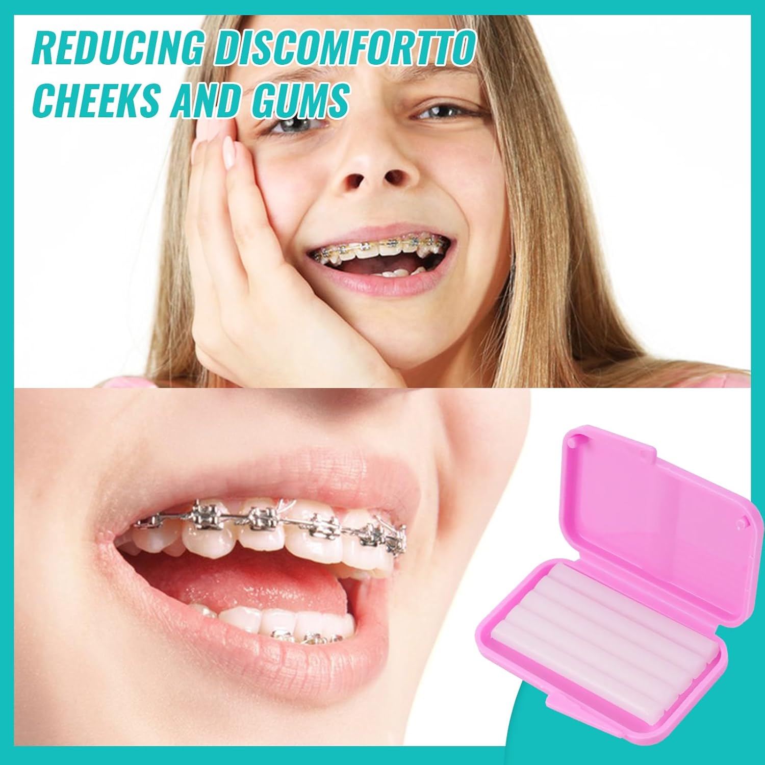 10box Dental Orthodontic Relie - огляд і ціна Teeth Whitening Gum