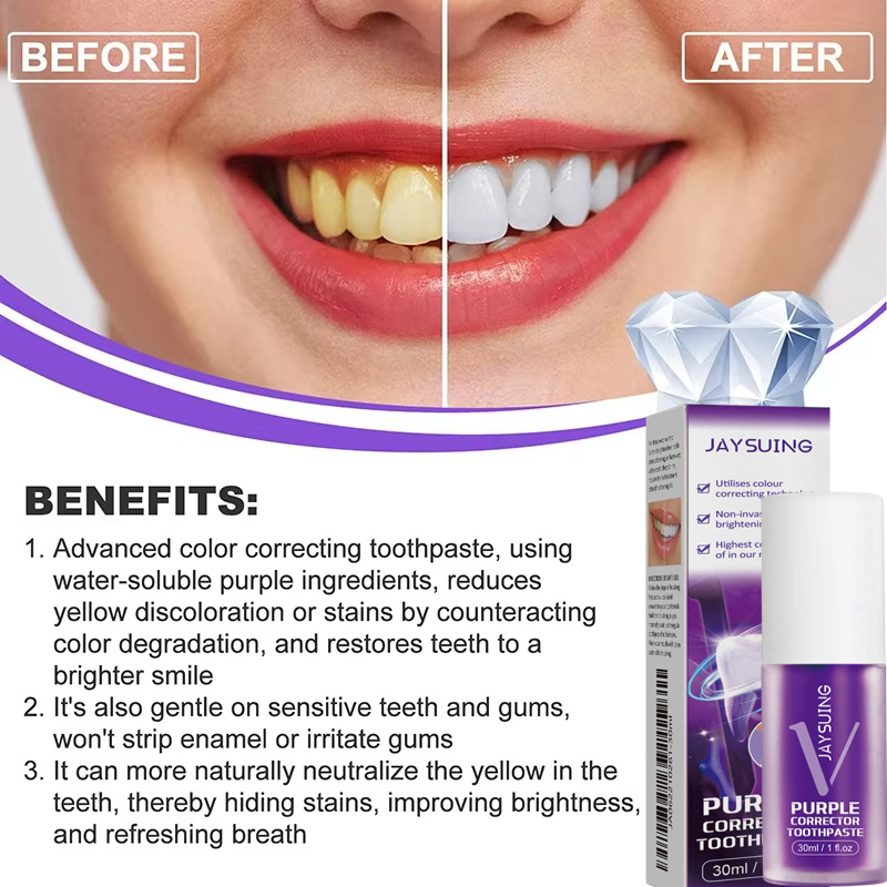Teeth Cleansing Whitening Toot - огляд і ціна Teeth Whitening Korea