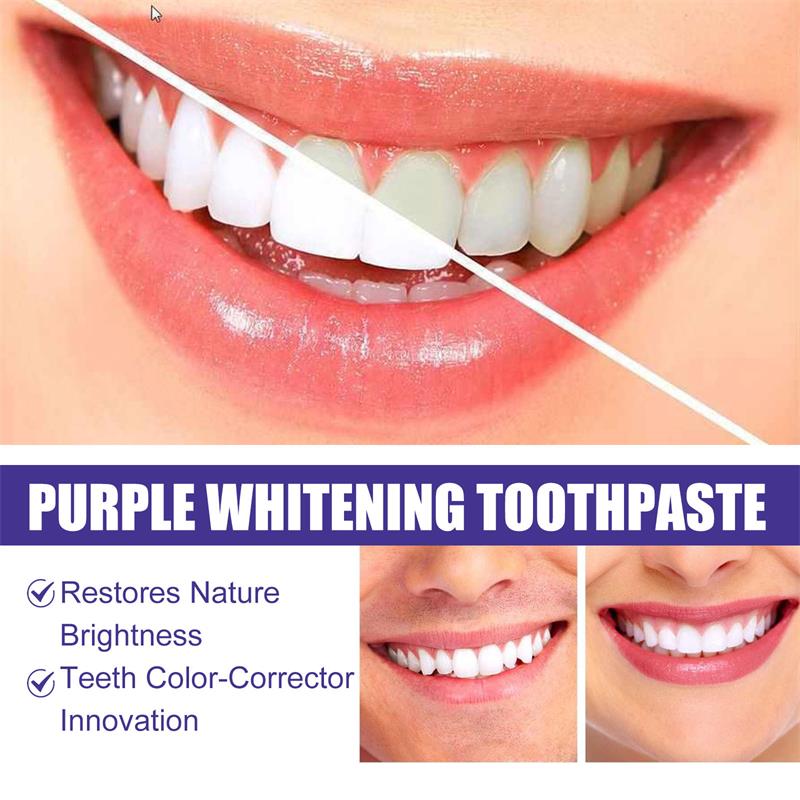 Teeth Cleansing Whitening Toot - огляд і ціна Teeth Whitening Korea