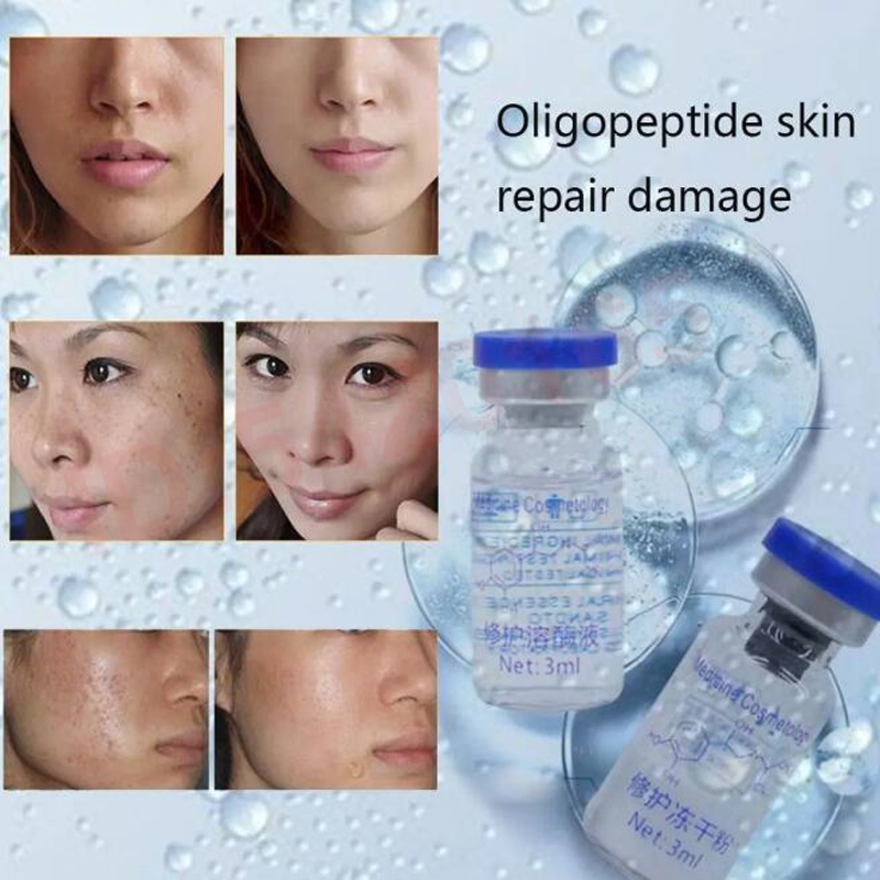 Active Unit EGF Repair Freeze- - огляд і ціна Whitening Powder Activated