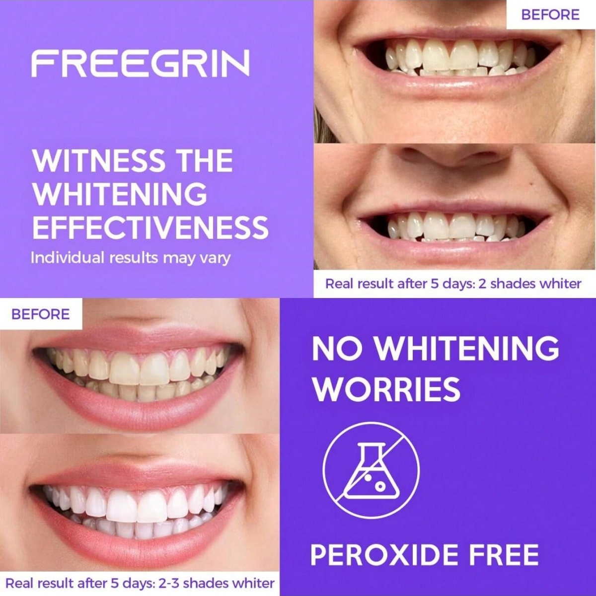 Deluxe Whitening Teeth Sticker - огляд і ціна Teeth Whitening Foam