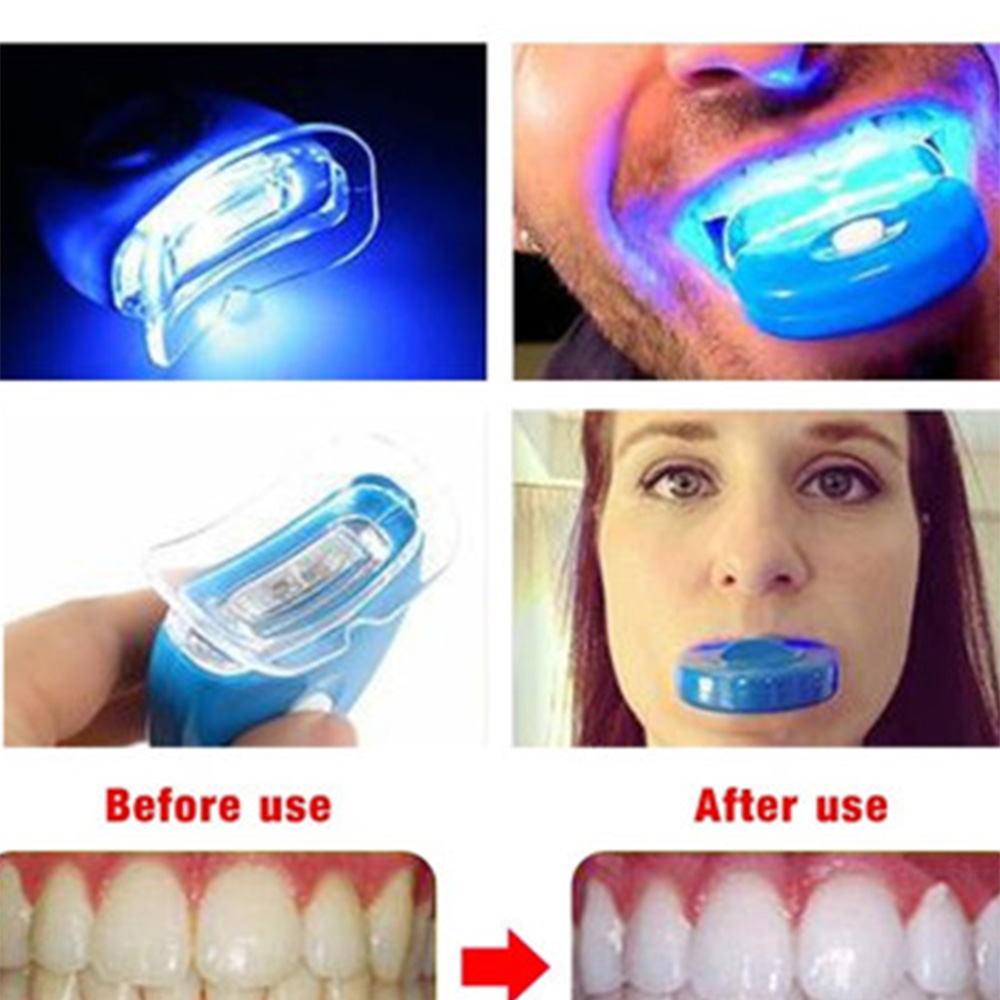 New Blue Led Teeth Whitening A - огляд і ціна Teeth Whitening With Laser
